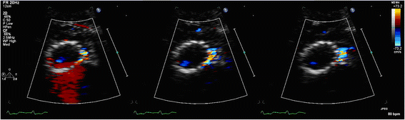 figure 12