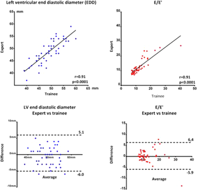 Global longitudinal strain calculation: on top showing tracking in