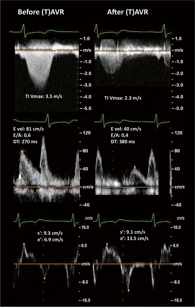 figure1