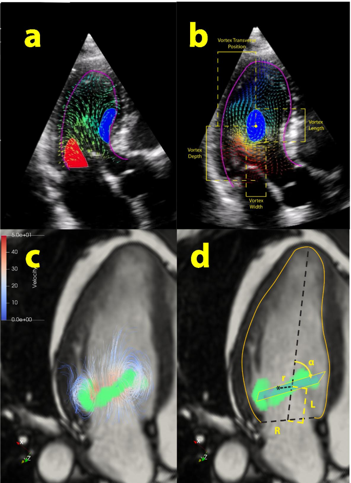 figure2