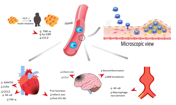 Regulatory effects of statins on CCL2/CCR2 axis in cardiovascular 