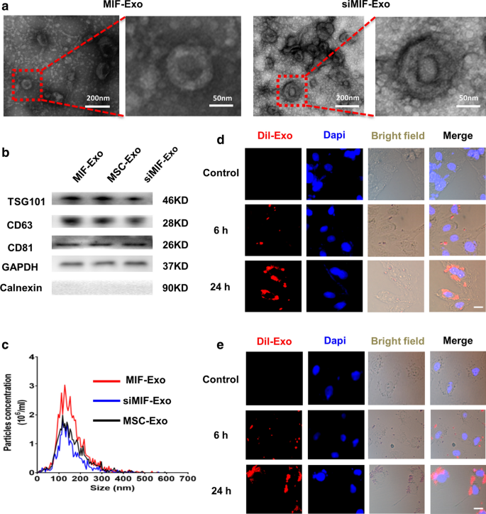 Macrophage Migration Inhibitory Factor Facilitates The Therapeutic Efficacy Of Mesenchymal Stem Cells Derived Exosomes In Acute Myocardial Infarction Through Upregulating Mir 133a 3p Springerlink