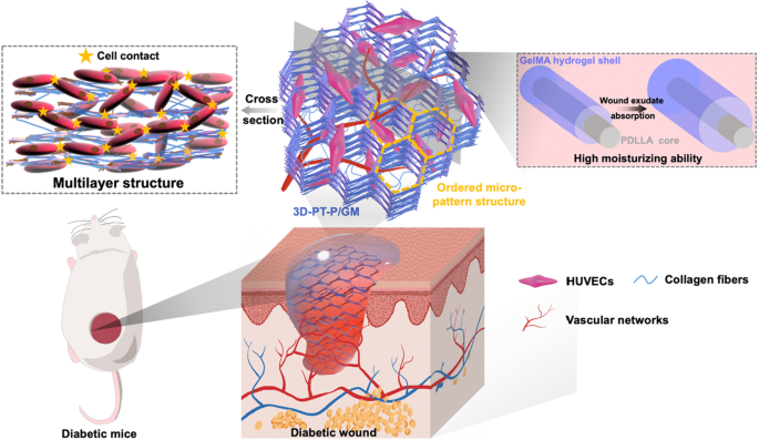 Nanofiber Hydrogel Core Shell Scaffolds With Three Dimensional Multilayer Patterned Structure For Accelerating Diabetic Wound Healing Journal Of Nanobiotechnology Full Text