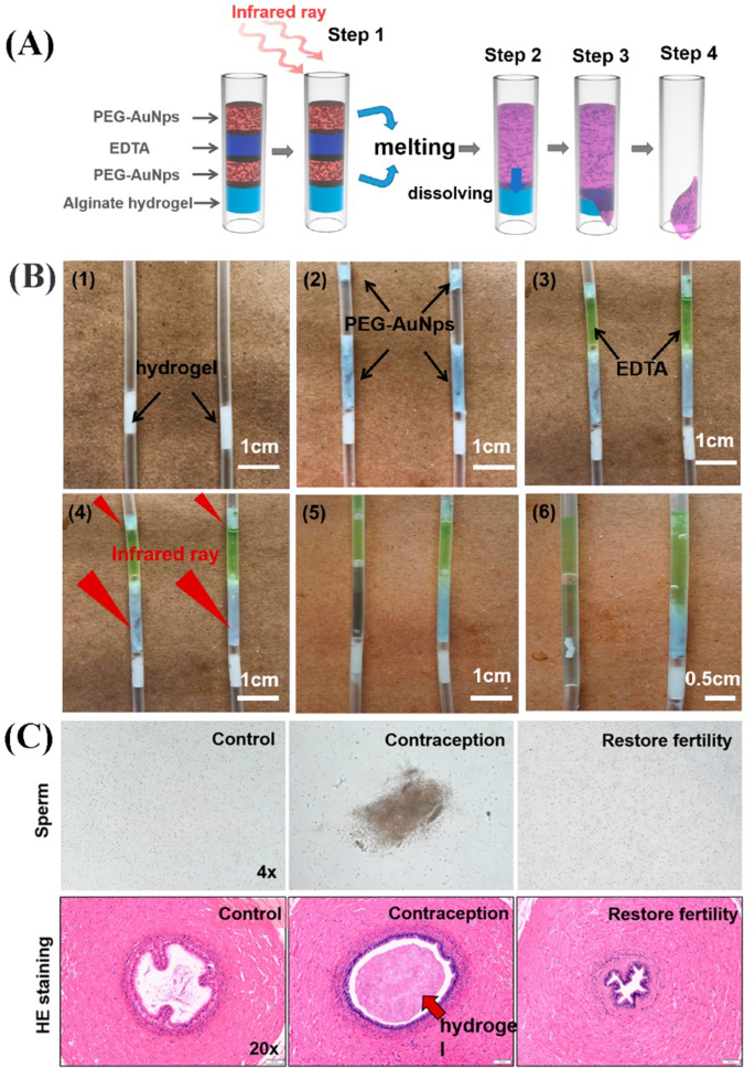 figure 11