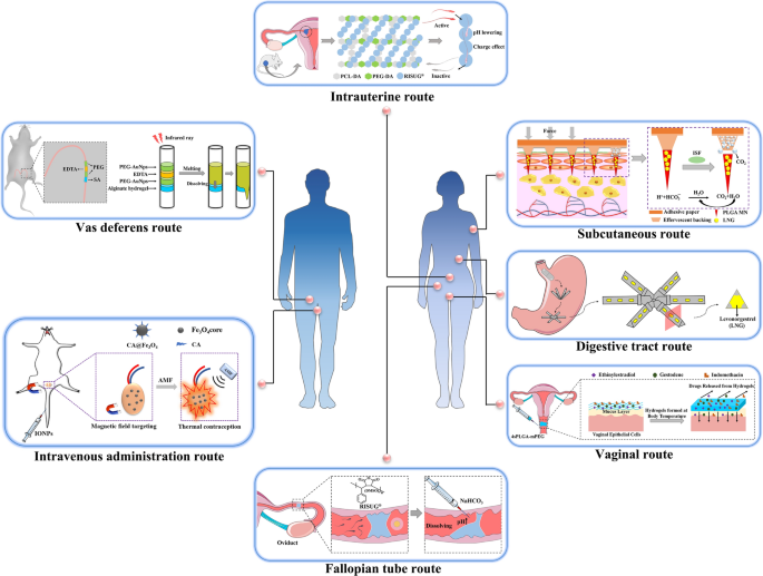 Recent progress in advanced biomaterials for long-acting reversible  contraception | Journal of Nanobiotechnology | Full Text