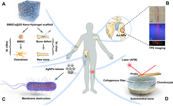 The advances in nanomedicine for bone and cartilage repair | Journal of  Nanobiotechnology | Full Text