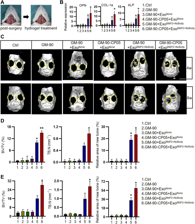 In Vivo High-Resolution Bioimaging of Bone Marrow and Fracture