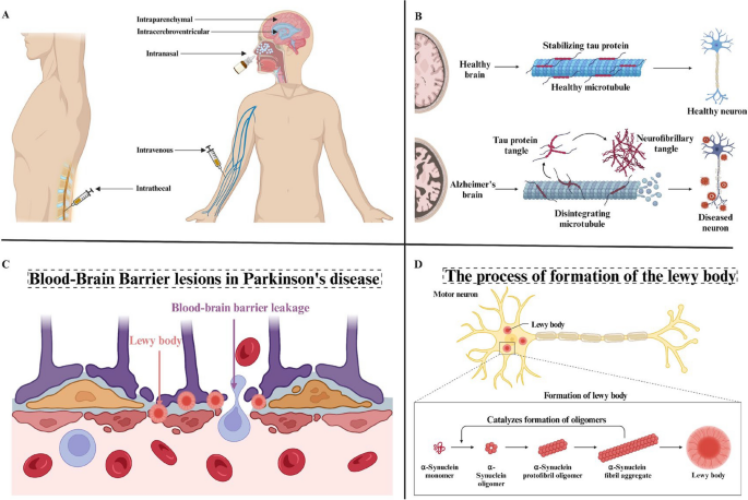 The bloodbrain barriers: novel nanocarriers for central nervous system  diseases | Journal of Nanobiotechnology | Springer Nature Link