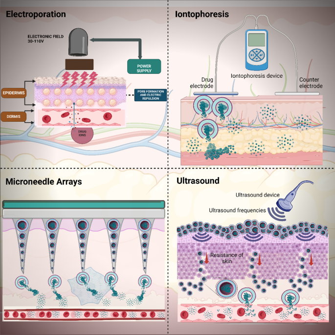 Strategic advances in liposomes technology: translational paradigm in  transdermal delivery for skin dermatosis | Journal of Nanobiotechnology |  Springer Nature Link