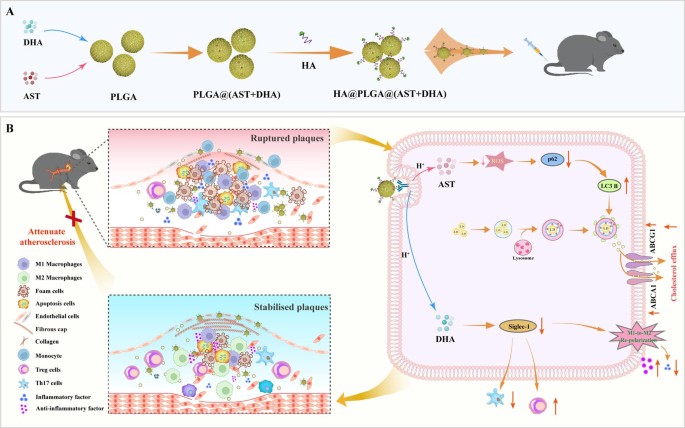 Astaxanthin and Dihydroartemisinin loaded PLGA NPs for atherosclerosis ...
