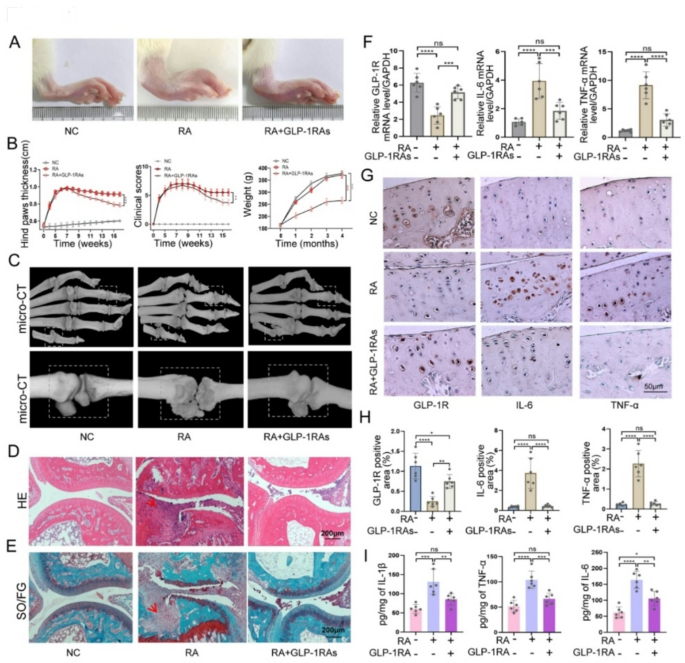 glp-1 microneedle patches Microneedle patches deliver targeted GLP-1RAs-loaded nanoparticles for the  treatment of rheumatoid arthritis | Journal of Nanobiotechnology