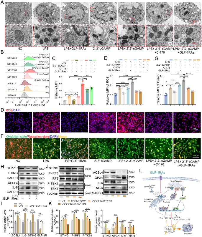 hypoglycemia and glp 1 Hypoglycemia After Gastric Bypass: The Dark Side of GLP-1