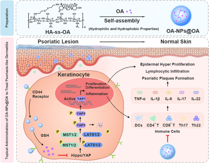 glutathione and psoriasis L-Glutamine for Psoriasis: Can It Help Treat Symptoms?