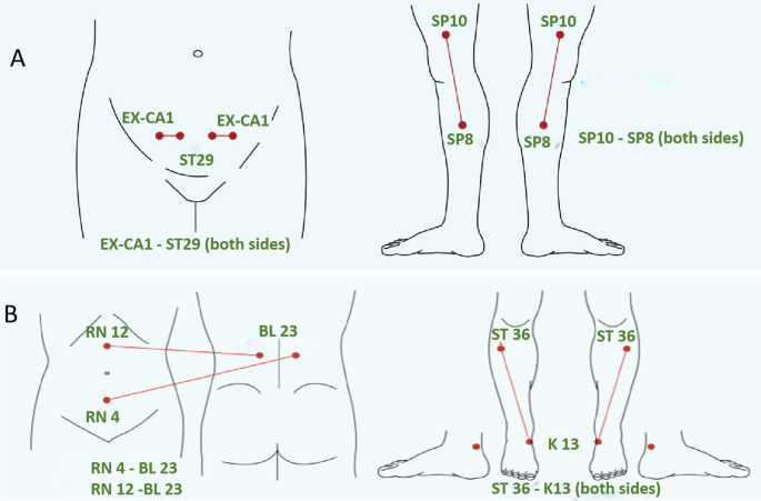 Transcutaneous electrical acupoint stimulation improves endometrial  receptivity resulting in improved IVF-ET pregnancy outcomes in older women:  a multicenter, randomized, controlled clinical trial | Reproductive Biology  and Endocrinology | Full Text