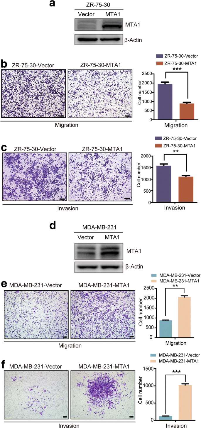 Overexpression Of Mta1 Inhibits The Metastatic Ability Of Zr 75 30 Cells In Vitro By Promoting Mta2 Degradation Cell Communication And Signaling Full Text