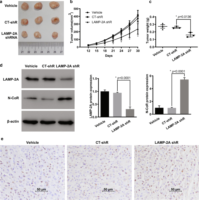 Discovery of LAMP-2A as potential biomarkers for glioblastoma development  by modulating apoptosis through N-CoR degradation | Cell Communication and  Signaling | Full Text
