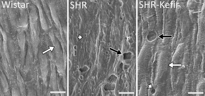 Chronic administration of the probiotic kefir improves the endothelial  function in spontaneously hypertensive rats | Journal of Translational  Medicine | Full Text