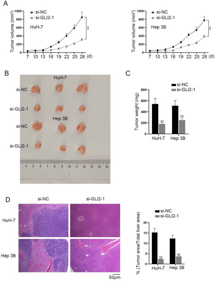 Circ_0036412 affects the proliferation and cell cycle of hepatocellular  carcinoma via hedgehog signaling pathway | Journal of Translational  Medicine | Full Text