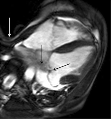 figure 24