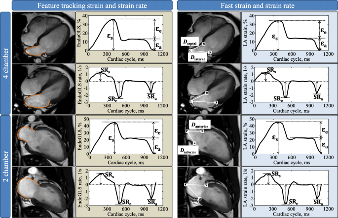 Feasibility and reproducibility of semi-automated longitudinal