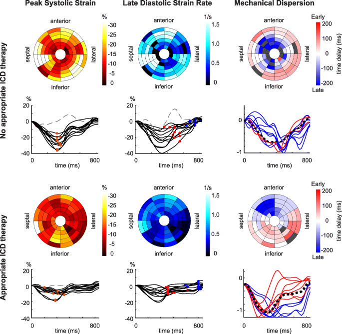 Value of peak strain dispersion in discovering left ventricular dysfunction  in diabetes mellitus