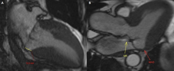 figure 19