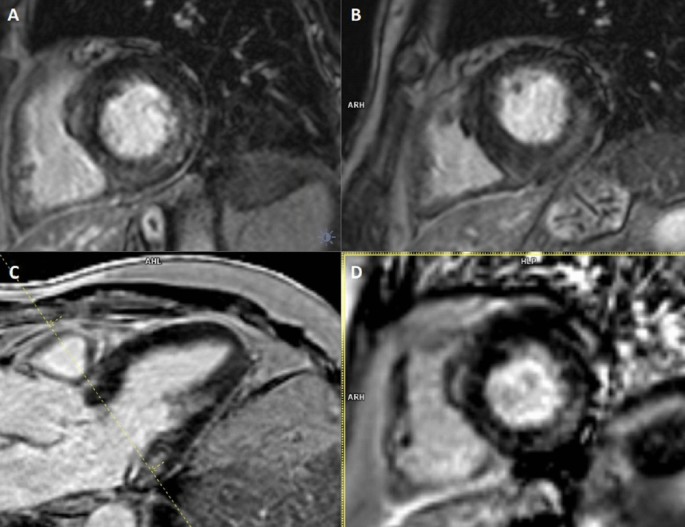 figure 20