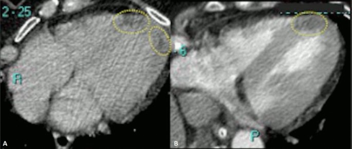 figure 29