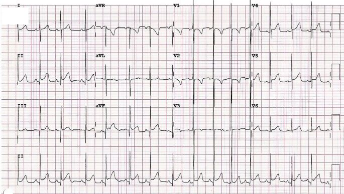 figure 35