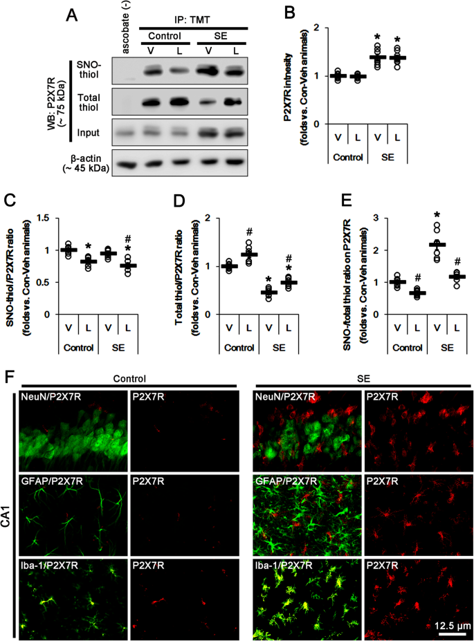 Protein Disulfide Isomerase Mediated S Nitrosylation Facilitates Surface Expression Of P2x7 Receptor Following Status Epilepticus Journal Of Neuroinflammation Full Text