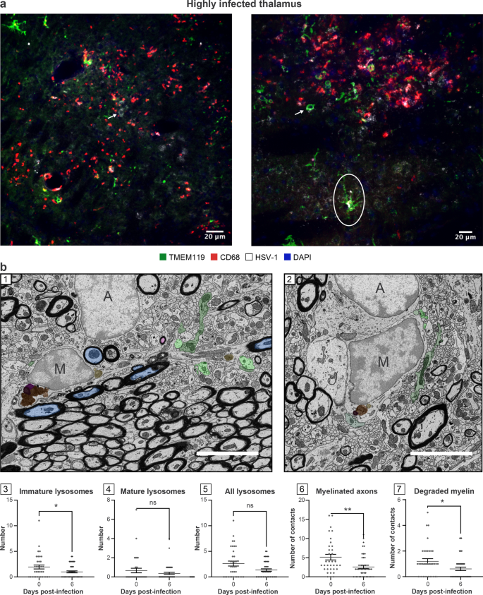 Herpes Simplex Virus-1 in the Brain: The Dark Side of a Sneaky Infection:  Trends in Microbiology