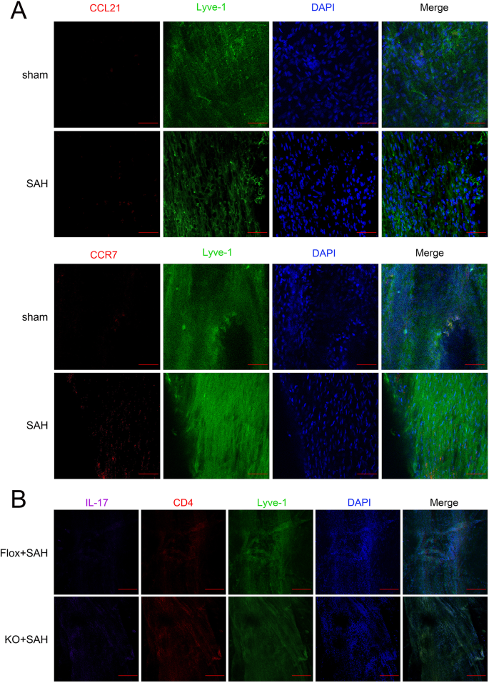 enhancing-th17-cells-drainage-through-meningeal-lymphatic-vessels-alleviate-neuroinflammation-after-subarachnoid-hemorrhage-journal-of-neuroinflammation-full-text