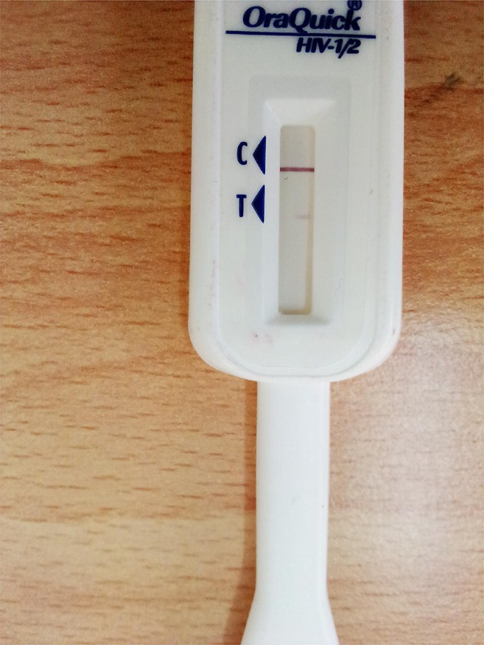 Hiv Home Test Kit