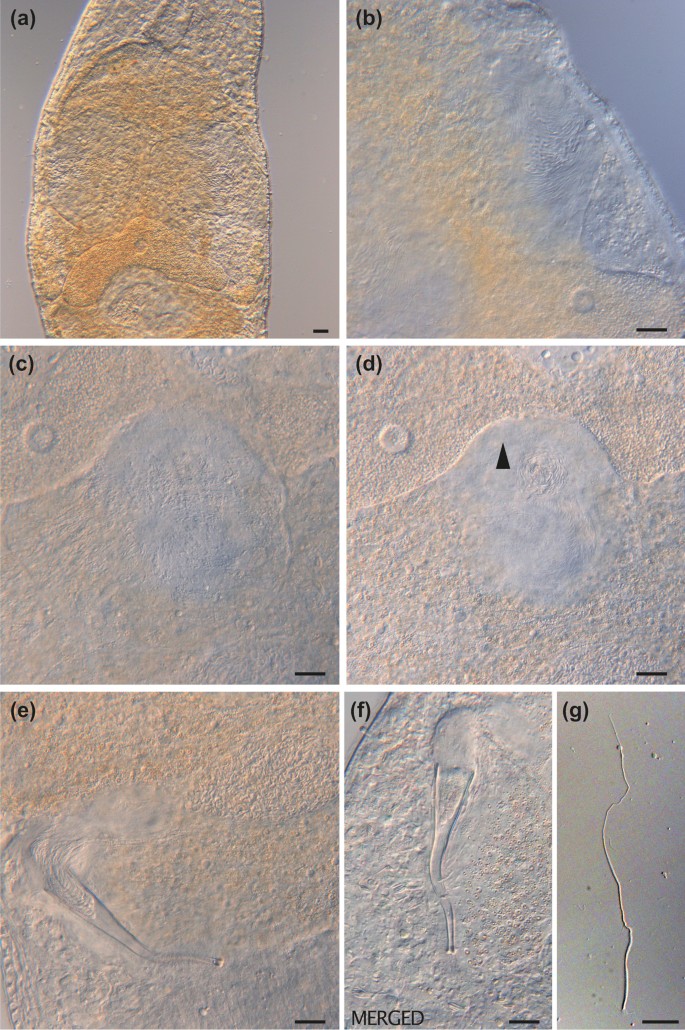 figure 15