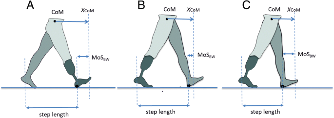 Walking With a Prosthetic Limb - Prosthetic Step Training