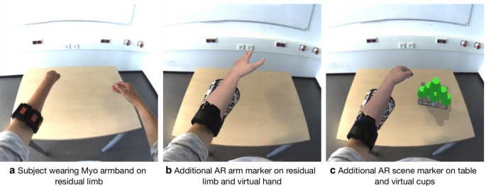 Perspective view of the prosthetic finger with individual components