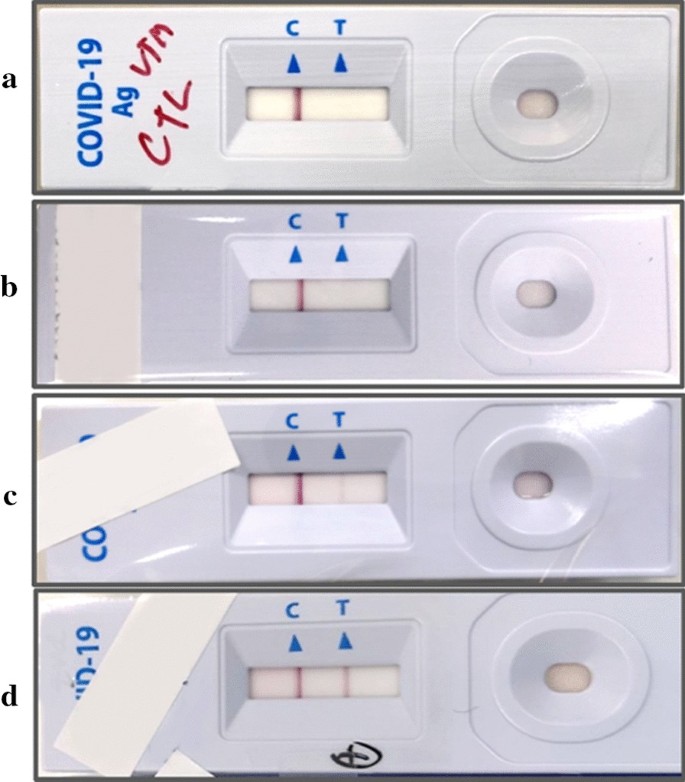 Rapid Sars Cov 2 Antigen Detection Assay In Comparison With Real Time Rt Pcr Assay For Laboratory Diagnosis Of Covid 19 In Thailand Virology Journal Full Text