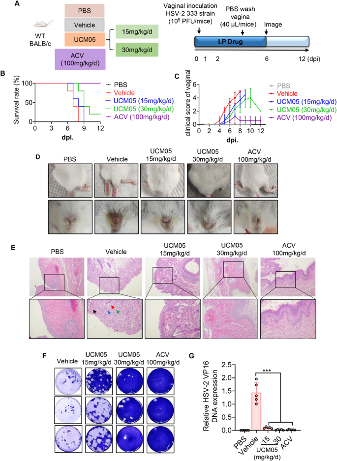 Small molecule UCM05 inhibits HSV-2 infection via targeting viral glycoproteins and fatty acid synthase with potentiating antiviral immunity | Virology Journal | Springer Nature Link Small molecule UCM05 inhibits HSV-2 infection via targeting viral glycoproteins and fatty acid synthase with potentiating antiviral immunity | Virology Journal | Springer Nature Link