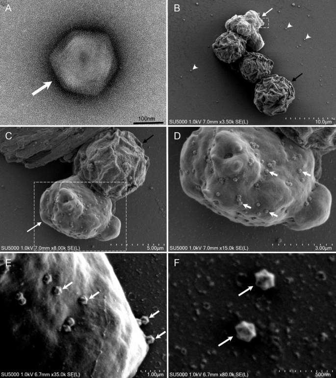 Usurpativirus massiliensis, a new giant virus related to ...