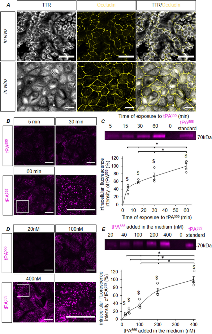 The choroid plexus: a door between the blood and the brain for tissue-type  plasminogen activator | Fluids and Barriers of the CNS | Full Text