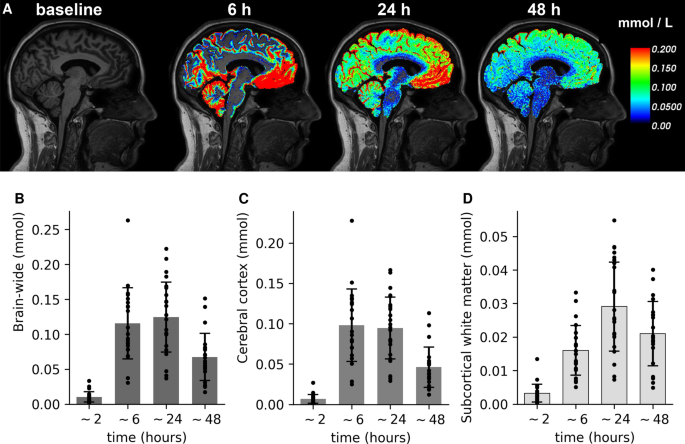 Shadow imaging for panoptical visualization of brain tissue in