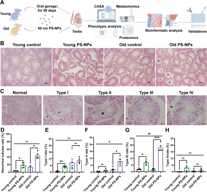 Multi-omics analysis of testis after long-term exposure to polystyrene ...