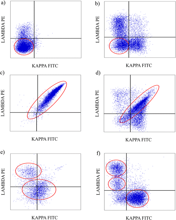 Inconclusive flow cytometric surface light chain results; can cytoplasmic  light chains, Bcl-2 expression and PCR clonality analysis improve accuracy  of cytological diagnoses in B-cell lymphomas? | Diagnostic Pathology | Full  Text