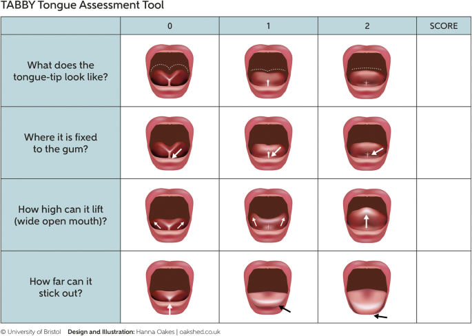 figure1