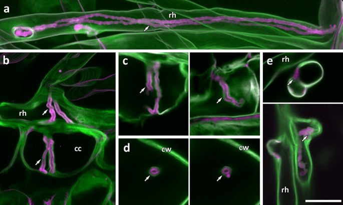 New methods for confocal imaging of infection threads in crop and model legumes | Plant Methods | Full Text New methods for confocal imaging of infection threads in crop and model legumes | Plant Methods | Full Text