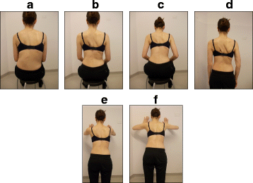 Torso Re-Shaping with Scoliosis-Specific Exercises and Custom