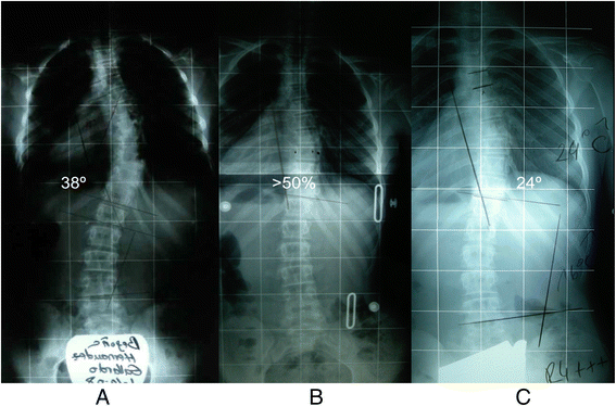 figure 61