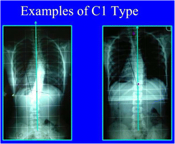 figure 32