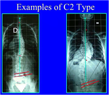 figure 34