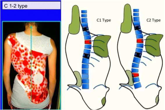 figure 49